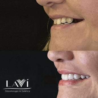 Snapinsta 1